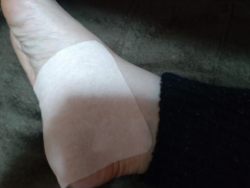 かかと側にロコアテープを貼った様子（足底筋膜の痛み対策）